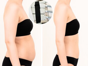 オリエンタルローザ 表参道(Oriental Rosa)の写真/日本初☆冷却痩身&EMS同時出力！最新パッド型なので吸引カップの跡が残らない！広範囲の脂肪を徹底分解！