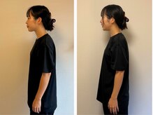 シゼン(Shizen)/ビフォーアフター