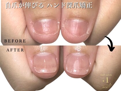 プラスワン(+1)の写真