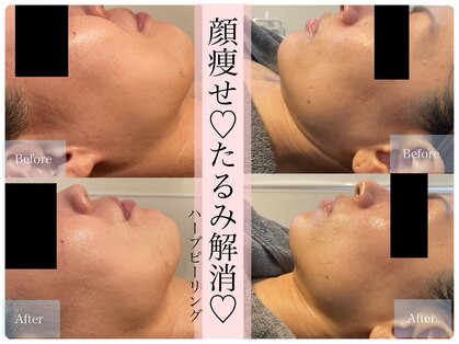 リアンビューティー(Lien Beauty)の写真