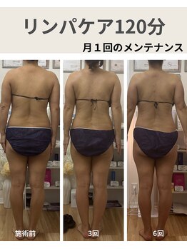 リア(Lia)/40代女性月1回のメンテナンス