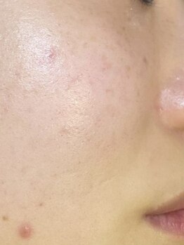 サロン ベルーチェ(SALON Belluce)の写真/《山科エリアにオープン》キッズスペース完備/駐車場有◎毎日忙しいあなたへ、非日常空間でリラックス♪