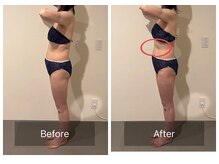 ボディケアアップ(BODY CARE UP↑)/WINBACK上半身　１回の変化