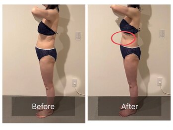 ボディケアアップ(BODY CARE UP↑)/WINBACK上半身　１回の変化