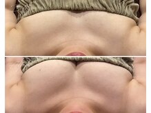 ローズドゥシャロン(Rose de CHALON)/全身バストケアプレミアムコース