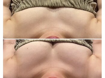 ローズドゥシャロン(Rose de CHALON)/全身バストケアプレミアムコース