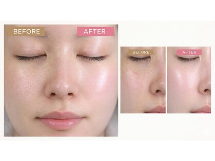 クリスタル(Crystal)の写真