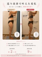 ハレキパ 鵠沼海岸(halekipa)/40代のお客様/肩こり・冷え改善