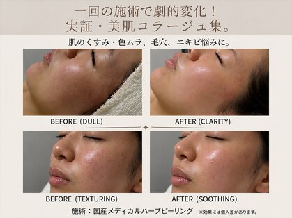 オーブ(Aube)の写真