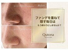 クトナ(Qutona)