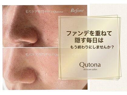 クトナ(Qutona)の写真