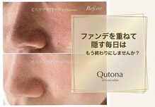 クトナ(Qutona)