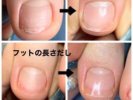 【トラブルフット】