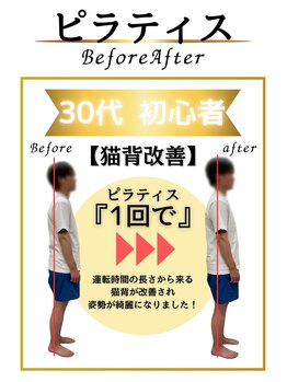 みなもと整骨院/30代　猫背