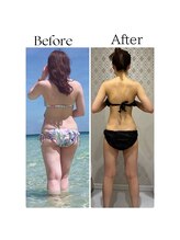 ラヴィニティ 池袋店(Lavinity)/女性らしい綺麗なラインを実現！