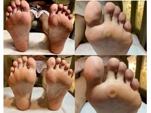 ビサンテ サロン/東海エリア実績TOPClass角質ケア