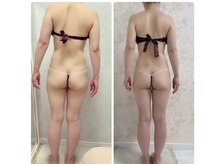 サロン ド ヂュエル(SALON DE JEWEL)の雰囲気（痩身コースでダイエット&姿勢改善が同時に叶います◎）