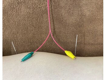 ジェネ鍼灸院/電気鍼