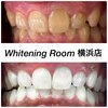 ホワイトニングルーム 横浜店(Whitening Room)のお店ロゴ