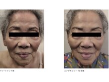 ミロク 伏見桃山店(miroku)/美しく歳を重ねる