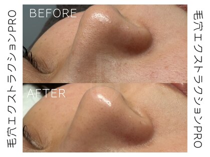 ベル(BELLE)の写真