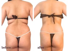 ハナ チュチュ(Hana chuchu)の雰囲気（セルゼロなら美しくサイズダウンが叶う★メリハリボディライン◎）