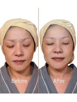 ハルム(HaluM)/1回でもこれだけトーンアップ★