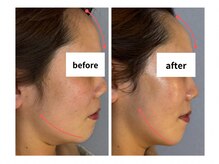 サロン シェリール(Salon Cherir)/小顔調整