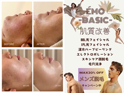 エモベーシック(e'MO BASIC)の写真