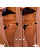 凪 横浜/浮腫みを溜めてしまうと。。。