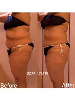 凪 横浜/浮腫みを溜めてしまうと。。。