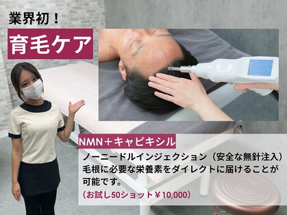 アンビー(Ambee)の写真