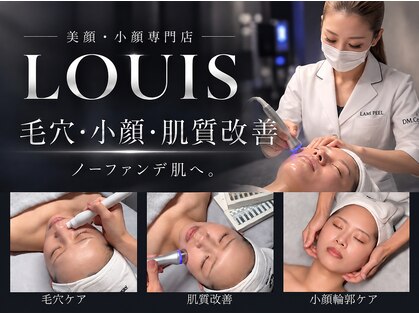 ルイス(LOUIS)の写真