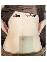 エンチャント(ENCHANT)/お腹くびれ超音波リフト