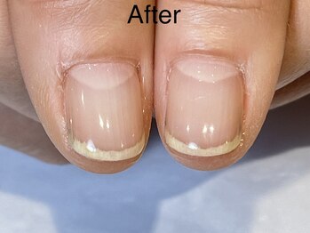 アンドネイル 海老名(&nail)/自爪育成ジェル　3回目です