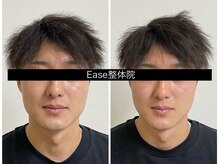 イース整体院(Ease整体院)/姿勢から整える小顔矯正が人気♪
