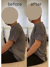 ウィズ鍼灸整骨院 東三国院(with.鍼灸整骨院)/矯正後変化