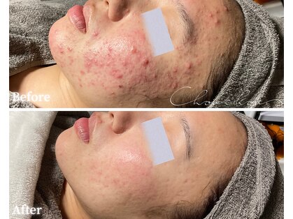 シュシュ(Chou chou)の写真