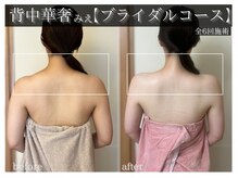 ラ ドゥーサ(La Dusa)/ブライダルコース6回お手入れ