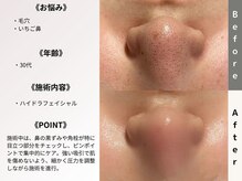 ルディラ 恵比寿店の雰囲気（【1回で毛穴消滅】医師監修技術◆毛穴洗浄ハイドラフェイシャル）
