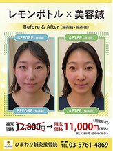 ひまわり鍼灸接骨院