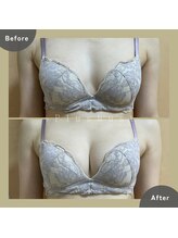 プラス バスト(+Plusバスト)/お客様BeforeAfterお写真