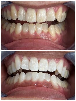 シャイニー 仙台駅東口(SHINY)/お客様の変化