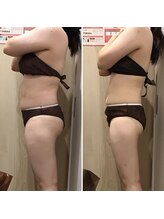 カンフリエ 吉野ヶ里店(Camphrier)/【痩身】ビフォーアフターご紹介