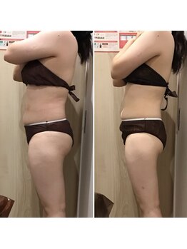 カンフリエ 吉野ヶ里店(Camphrier)/【痩身】ビフォーアフターご紹介