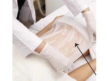 ルキア(LUKIA)/脂肪冷却カップを乗せる前に