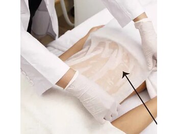 ルキア(LUKIA)/脂肪冷却カップを乗せる前に