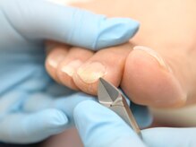 巻き爪専門ラボ 名古屋栄店/爪切りだけでも◯