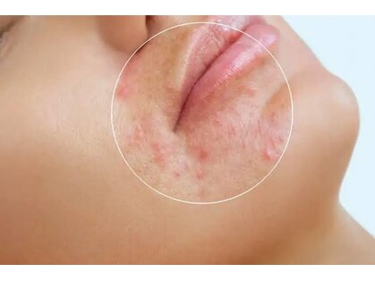トータルビューティサロン リボーテ(Re:Beaute)の写真