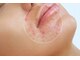 トータルビューティサロン リボーテ(Re:Beaute)の写真